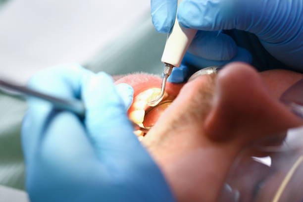 Best Pediatric Emergency Dentist in Byron, IL