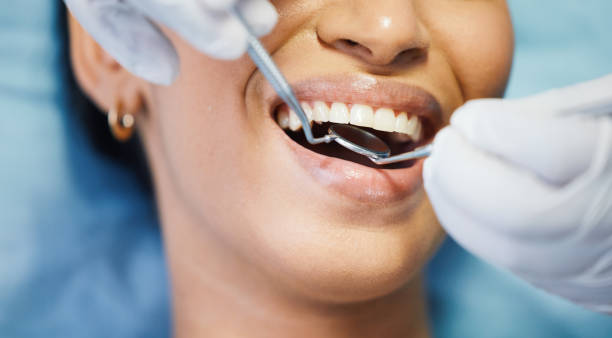 Best Emergency Dental Care for Broken or Chipped Teeth in Byron, IL